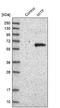 Melanocyte Inducing Transcription Factor antibody, NBP1-88618, Novus Biologicals, Western Blot image 