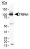 Transient Receptor Potential Cation Channel Subfamily A Member 1 antibody, TA309920, Origene, Western Blot image 