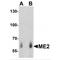 Malic enzyme 2 antibody, MBS153703, MyBioSource, Western Blot image 