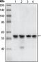 Checkpoint Kinase 1 antibody, TA336271, Origene, Western Blot image 