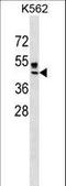 RING finger protein 204 antibody, LS-C157520, Lifespan Biosciences, Western Blot image 