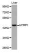 VPS37A Subunit Of ESCRT-I antibody, abx001269, Abbexa, Western Blot image 
