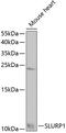 Secreted Ly-6/uPAR-related protein 1 antibody, 22-719, ProSci, Western Blot image 