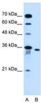 Solute Carrier Family 25 Member 32 antibody, TA333640, Origene, Western Blot image 