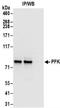 6-phosphofructokinase, muscle type antibody, NBP2-32170, Novus Biologicals, Western Blot image 