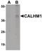 Calcium Homeostasis Modulator 1 antibody, PA5-20895, Invitrogen Antibodies, Western Blot image 