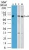SKI Like Proto-Oncogene antibody, PA1-41293, Invitrogen Antibodies, Western Blot image 