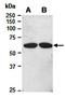 Lymphatic Vessel Endothelial Hyaluronan Receptor 1 antibody, orb67035, Biorbyt, Western Blot image 