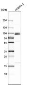 Microcephalin 1 antibody, HPA008238, Atlas Antibodies, Western Blot image 