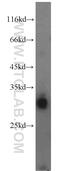 Lactate Dehydrogenase A Like 6A antibody, 16221-1-AP, Proteintech Group, Western Blot image 