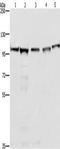 Minichromosome Maintenance Complex Component 6 antibody, TA349393, Origene, Western Blot image 