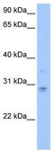 Defective In Cullin Neddylation 1 Domain Containing 3 antibody, TA337792, Origene, Western Blot image 