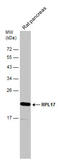 Ribosomal Protein L17 antibody, GTX101831, GeneTex, Western Blot image 