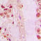 Nuclear Factor, Erythroid 2 Like 2 antibody, LS-C352566, Lifespan Biosciences, Immunohistochemistry paraffin image 