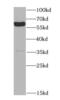 Monoamine Oxidase A antibody, FNab04970, FineTest, Western Blot image 