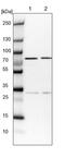 Conserved oligomeric Golgi complex subunit 6 antibody, PA5-59163, Invitrogen Antibodies, Western Blot image 