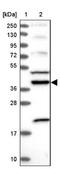 Armadillo Repeat Containing 4 antibody, NBP1-84175, Novus Biologicals, Western Blot image 