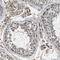 PAP-III antibody, HPA013431, Atlas Antibodies, Immunohistochemistry frozen image 