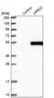 Leucine Rich Repeat Containing 2 antibody, PA5-58668, Invitrogen Antibodies, Western Blot image 