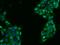 Fatty Acyl-CoA Reductase 2 antibody, 202539-T10, Sino Biological, Immunohistochemistry paraffin image 