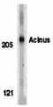 Apoptotic Chromatin Condensation Inducer 1 antibody, orb74393, Biorbyt, Western Blot image 