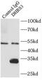 Dehydrogenase/Reductase 3 antibody, FNab02372, FineTest, Immunoprecipitation image 