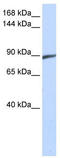 Spermatogenesis-associated protein 5 antibody, TA340394, Origene, Western Blot image 