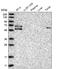 Gamma-Glutamyltransferase 6 antibody, NBP1-81882, Novus Biologicals, Western Blot image 