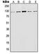 Lysosomal Associated Membrane Protein 1 antibody, orb214178, Biorbyt, Western Blot image 