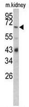 Complement factor B antibody, AP50876PU-N, Origene, Western Blot image 