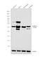 Protein Phosphatase 1 Regulatory Inhibitor Subunit 1B antibody, MA5-14968, Invitrogen Antibodies, Western Blot image 