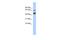 Zinc Finger Protein 578 antibody, A17718, Boster Biological Technology, Western Blot image 