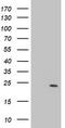 Proteasome Subunit Beta 9 antibody, TA504348, Origene, Western Blot image 
