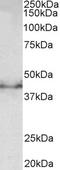 Doublecortin antibody, STJ72841, St John