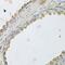 Mitochondrial Transcription Termination Factor 3 antibody, GTX65988, GeneTex, Immunohistochemistry paraffin image 