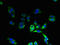 HIG1 Hypoxia Inducible Domain Family Member 1B antibody, LS-C398013, Lifespan Biosciences, Immunofluorescence image 