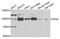 Phosphofructokinase, Platelet antibody, STJ110225, St John