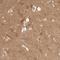 Brain and acute leukemia cytoplasmic protein antibody, HPA027132, Atlas Antibodies, Immunohistochemistry paraffin image 