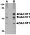 Polypeptide N-Acetylgalactosaminyltransferase 10 antibody, NBP1-77059, Novus Biologicals, Western Blot image 