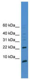 Prostate Stem Cell Antigen antibody, TA346414, Origene, Western Blot image 