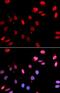 E3 ubiquitin-protein ligase RAD18 antibody, FNab07075, FineTest, Immunofluorescence image 
