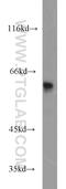 Karyopherin Subunit Alpha 5 antibody, 13963-1-AP, Proteintech Group, Western Blot image 