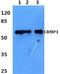 Dihydropyrimidinase Like 4 antibody, PA5-36585, Invitrogen Antibodies, Western Blot image 