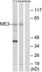 NADP-dependent malic enzyme, mitochondrial antibody, GTX87324, GeneTex, Western Blot image 