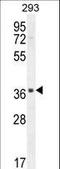 Sperm Acrosome Associated 1 antibody, LS-C162850, Lifespan Biosciences, Western Blot image 