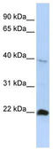 NK3 Homeobox 2 antibody, TA332157, Origene, Western Blot image 