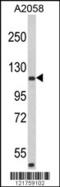Rho GTPase Activating Protein 45 antibody, 62-570, ProSci, Western Blot image 
