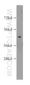 Eukaryotic Translation Initiation Factor 4A2 antibody, 16119-1-AP, Proteintech Group, Western Blot image 