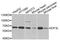Eukaryotic translation initiation factor 3 subunit L antibody, A9972, ABclonal Technology, Western Blot image 