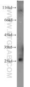 Ras-related protein Rab-3B antibody, 15774-1-AP, Proteintech Group, Western Blot image 